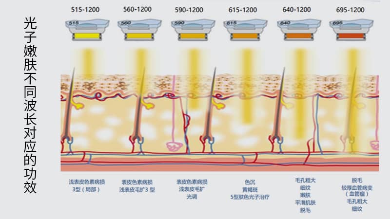 光子嫩肤的功效与作用有哪些?