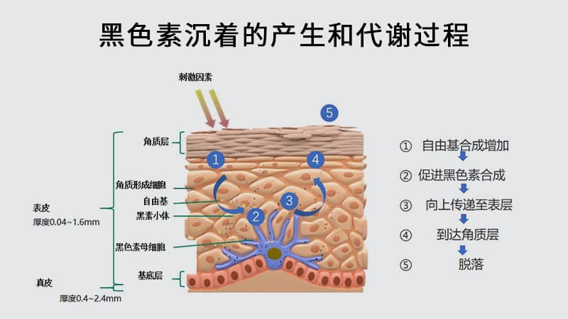 黑色素沉着的产生和代谢过程
