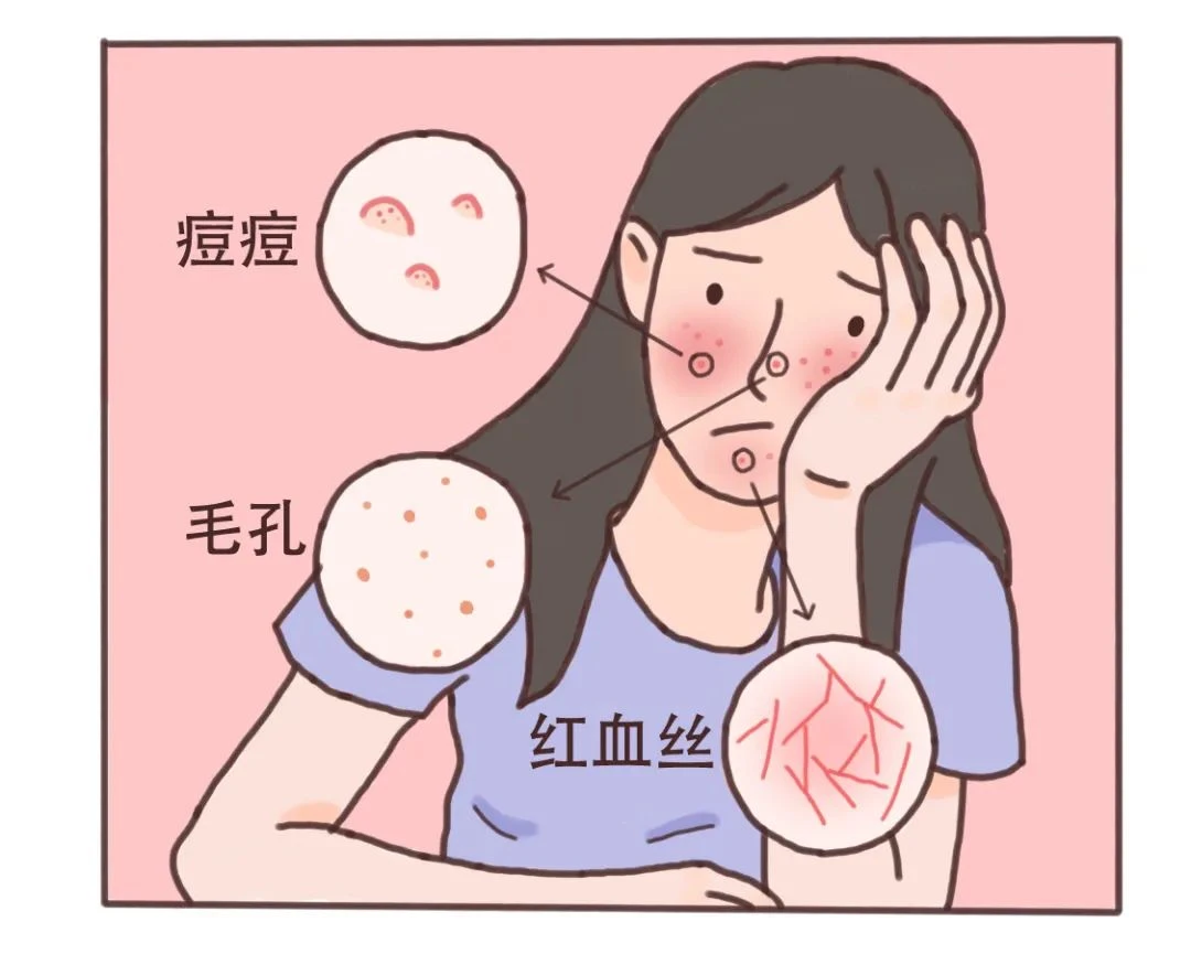 红血丝是什么原因导致的?
