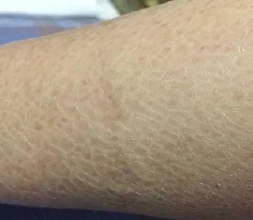 冬季频繁洗澡会给你皮肤带来哪些影响?