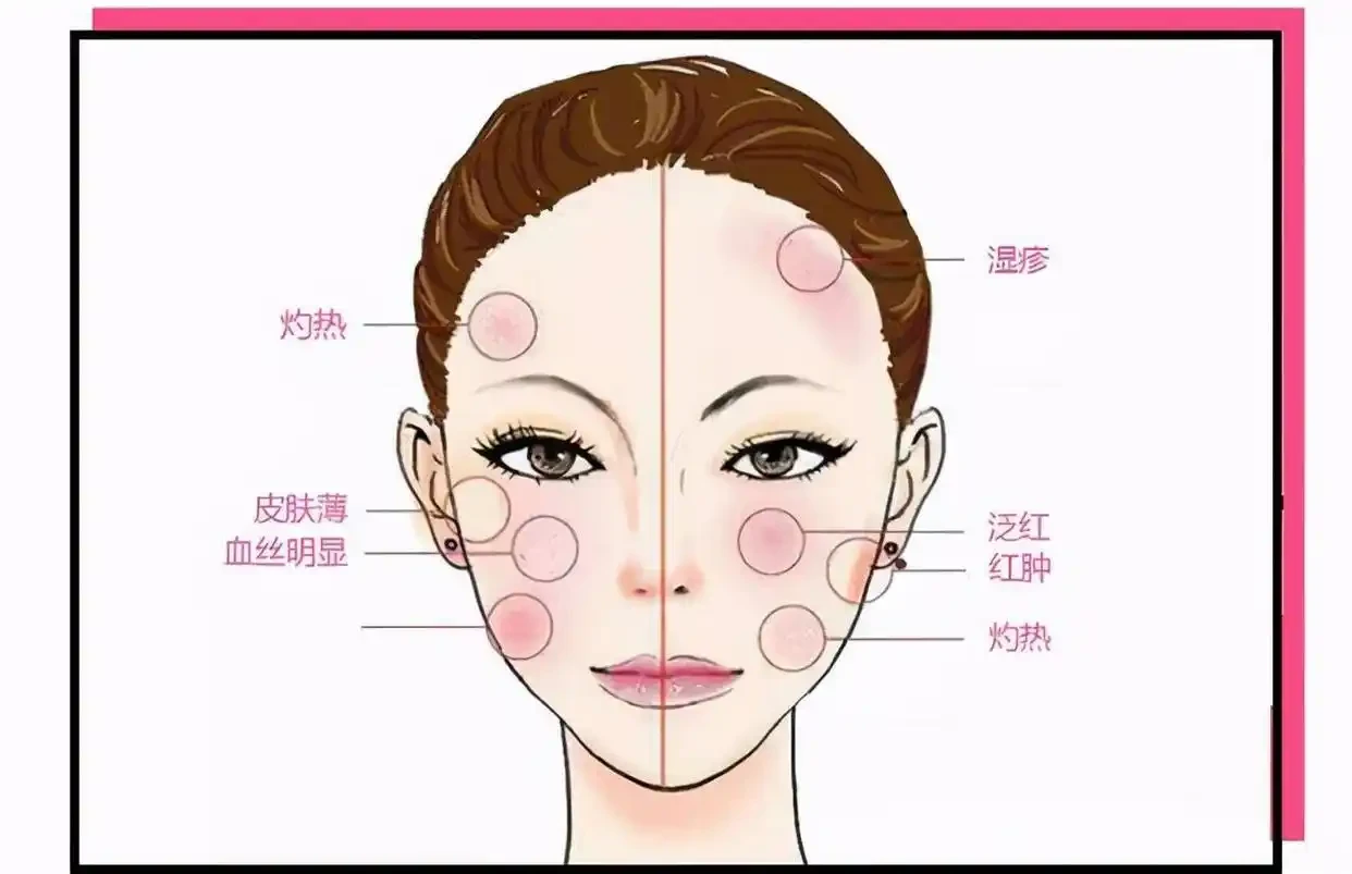 皮肤过敏会给我们皮肤带来什么影响?